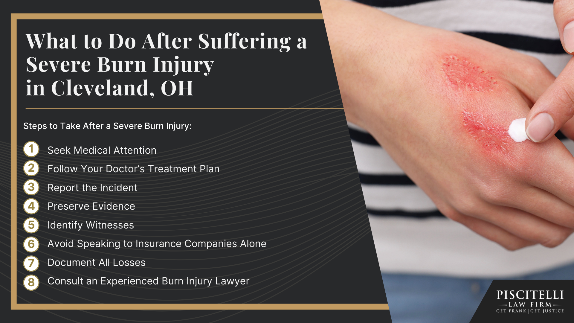 Meet Our Founder and Experienced Slip and Fall Attorney_ Frank Piscitelli; What to Do After Suffering a Severe Burn Injury in Cleveland, OH