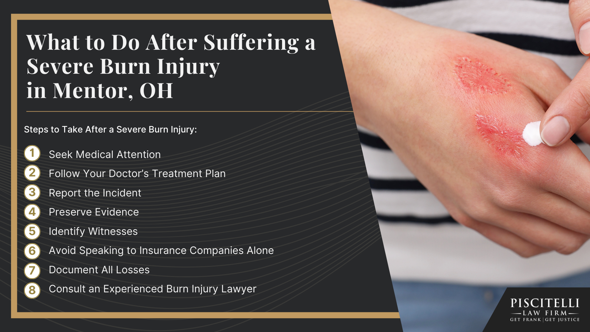 Meet Our Founder and Experienced Slip and Fall Attorney_ Frank Piscitelli; What to Do After Suffering a Severe Burn Injury in Cleveland, OH